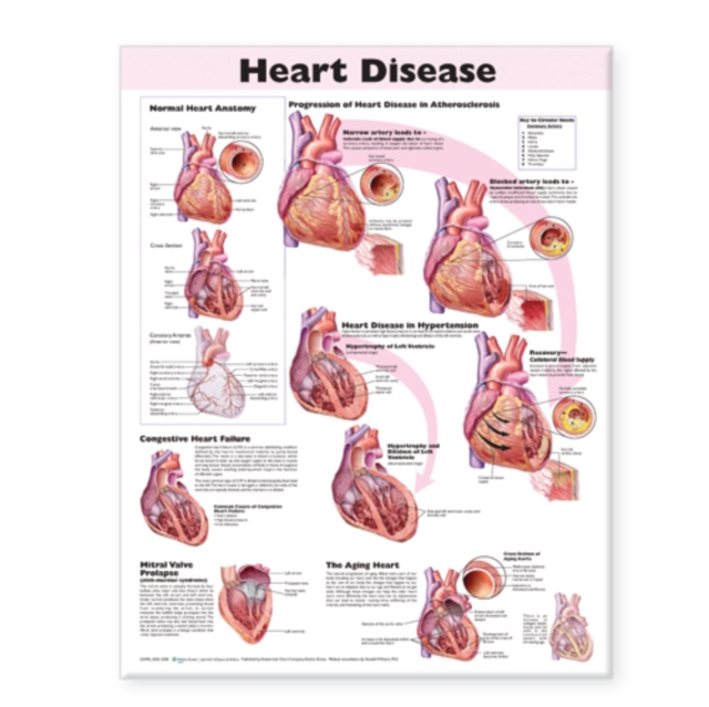 Heart Disease Anatomical Chart 9780781773379 WHSmith