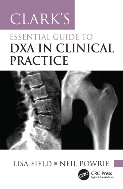 Clark's Essential Guide to DXA in Clinical Practice: Lisa Field ...