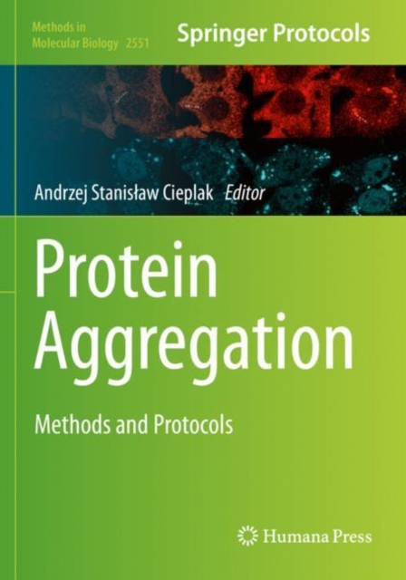 Protein Aggregation : Methods and Protocols: : 9781071625996: TGJones