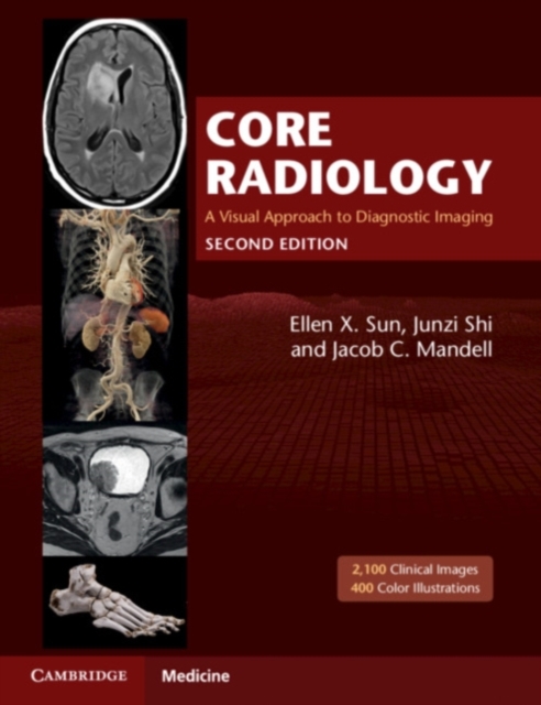 健康・医学 Radiology and Pathology Correlation Core Radiology : A Visual Approach to Diagnostic Imaging