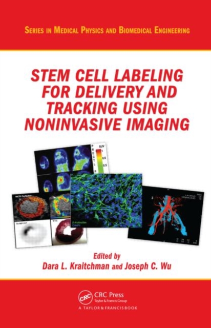 Stem Cell Labeling for Delivery and Tracking Using Noninvasive Imaging ...